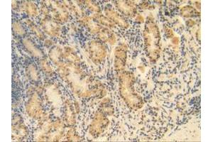 IHC-P analysis of Human Stomach Tissue, with DAB staining. (MGP anticorps  (AA 1-103))