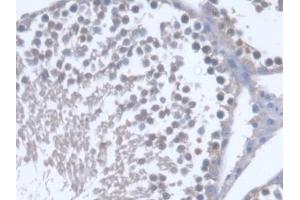 DAB staining on IHC-P; Samples: Rat Testis Tissue