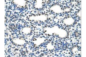 Image no. 1 for anti-protein ariadne-2 homolog (ARIH2) (N-Term) antibody (ABIN203288)