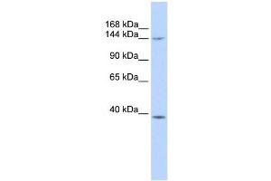 SMC4 antibody used at 1 ug/ml to detect target protein. (SMC4 anticorps  (Middle Region))