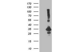 Western Blotting (WB) image for anti-Phenylethanolamine N-Methyltransferase (PNMT) antibody (ABIN1500308) (PNMT anticorps)