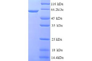 SDS-PAGE (SDS) image for Chromosome 1 Open Reading Frame 106 (C1ORF106) (AA 1-578), (full length) protein (His tag) (ABIN5714366) (C1ORF106 Protein (AA 1-578, full length) (His tag))