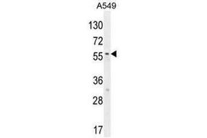 SYNCI Antibody (N-term) western blot analysis in A549 cell line lysates (35µg/lane). (Syncoilin anticorps  (N-Term))