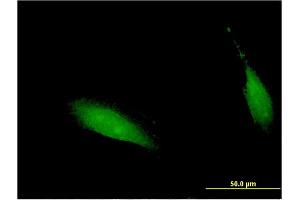 Immunofluorescence of monoclonal antibody to CENPV on HeLa cell. (CENPV anticorps  (AA 173-272))
