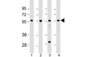 Western blot testing of human 1) fetal liver, 2) lung, 3) Jurkat and 4) K562 cell lysate with EFS antibody at 1:2000. (EFS anticorps  (AA 367-399))