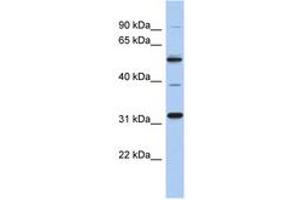 Image no. 1 for anti-TBC1 Domain Family, Member 26 (TBC1D26) (AA 107-156) antibody (ABIN6743882) (TBC1D26 anticorps  (AA 107-156))