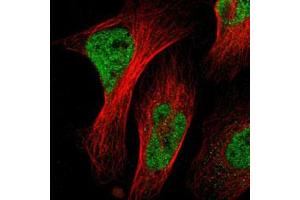 Immunofluorescent staining of U-2 OS with NACC1 polyclonal antibody  (Green) shows positivity in nucleus but excluded from the nucleoli. (NAC1 anticorps)
