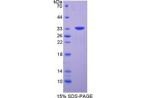 Image no. 1 for Mechanistic Target of Rapamycin (serine/threonine Kinase) (mTOR) (AA 2226-2488) protein (His tag) (ABIN6237749) (MTOR Protein (AA 2226-2488) (His tag))