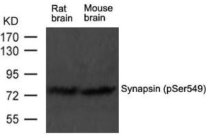 Western blot analysis of extract from rat brain and mouse brain tissue using Synapsin(phospho-Ser549) Antibody using