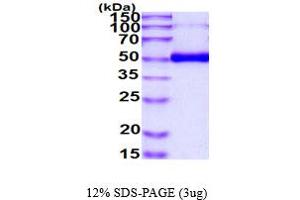Basic Transcription Factor 3 Pseudogene 11 (BTF3P11) (AA 22-401) (Active) protein (His tag)