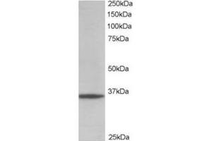 Image no. 1 for anti-Glyceraldehyde-3-Phosphate Dehydrogenase (GAPDH) (C-Term) antibody (ABIN374435)