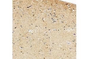 anti-Ubiquitin Protein Ligase E3A (ube3a) (AA 1-860) antibody