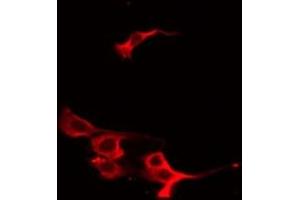 ABIN6267547 staining HeLa by IF/ICC. (VASP anticorps  (pSer239))