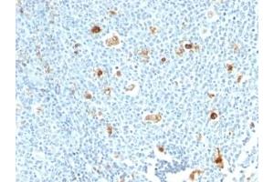 Formalin-fixed, paraffin-embedded human tonsil stained with Calprotectin antibody (CPT/1028) (Calprotectin anticorps)