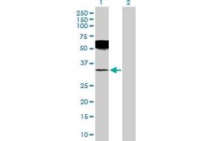 Western Blot analysis of UCHL1 expression in transfected 293T cell line by UCHL1 MaxPab polyclonal antibody. (UCHL1 anticorps  (AA 1-223))