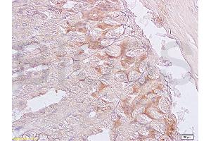 Formalin-fixed and paraffin embedded mouse stomach labeled with Anti-SGCB/SGC Polyclonal Antibody, Unconjugated (ABIN738051) at 1:200 followed by conjugation to the secondary antibody and DAB staining. (SGCB anticorps  (AA 165-260))