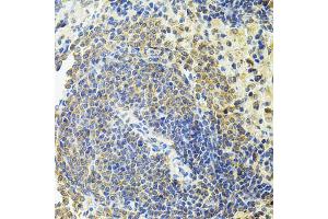 Immunohistochemistry of paraffin-embedded rat spleen using RALBP1 antibody (ABIN5970488) at dilution of 1/100 (40x lens). (RALBP1 anticorps)
