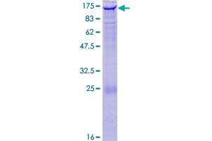 Image no. 1 for EPH Receptor A4 (EPHA4) (AA 1-986) protein (GST tag) (ABIN1352925)