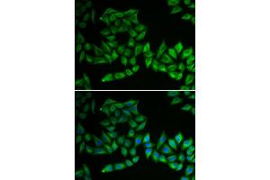 Immunofluorescence analysis of U2OS cell using TPMT antibody. (TPMT anticorps)