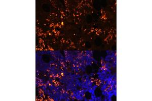 Immunofluorescence analysis of rat bone marrow cells using GPR55 antibody (ABIN6130402, ABIN6141351, ABIN6141352 and ABIN6216688) at dilution of 1:100. (GPR55 anticorps  (AA 210-319))