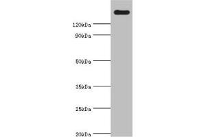 Western blot All lanes: CARD11 antibody at 4 μg/mL + K562 whole cell lysate Secondary Goat polyclonal to rabbit IgG at 1/10000 dilution Predicted band size: 133 kDa Observed band size: 133 kDa (CARD11 anticorps  (AA 985-1154))