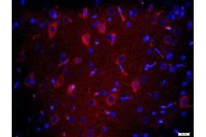 Paraformaldehyde-fixed, paraffin embedded rat brain tissue, Antigen retrieval by boiling in sodium citrate buffer(pH6) for 15min, Block endogenous peroxidase by 3% hydrogen peroxide for 20 minutes, Blocking buffer (normal goat serum) at 37°C for 30min, Antibody incubation with TMEM158 Polyclonal Antibody, Unconjugated  at 1:200 overnight at 4°C, followed by a conjugated secondary and DAPI staining