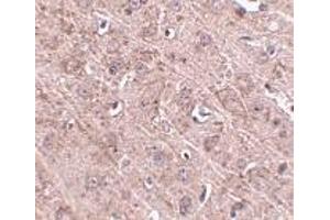 Immunohistochemistry of Gle1 in mouse brain tissue with Gle1 antibody at 2.
