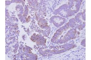 Image no. 1 for anti-CG1458 (CG1458) (AA 1-133) antibody (ABIN1496301) (CG1458 anticorps  (AA 1-133))