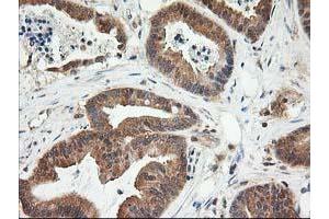 Image no. 5 for anti-LSM1 Homolog, U6 Small Nuclear RNA Associated (LSM1) antibody (ABIN1499210)