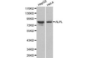 Western blot analysis of HepG2 cell and Hela cell lysate using ALPL antibody. (ALPL anticorps  (AA 20-270))