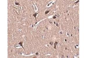 Immunohistochemistry (IHC) image for anti-Zinc Finger Protein 667 (ZNF667) (N-Term) antibody (ABIN1031458) (ZNF667 anticorps  (N-Term))