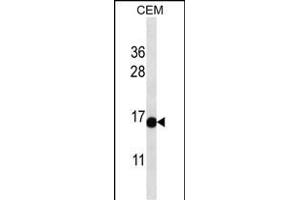 PRR15L anticorps  (C-Term)