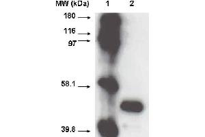 Western blot using CYP2A6 antibody  on recombinant cytochrome p450 at 1 µg/ml.