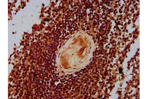 IHC image of ABIN7165194 diluted at 1:300 and staining in paraffin-embedded human spleen tissue performed on a Leica BondTM system.