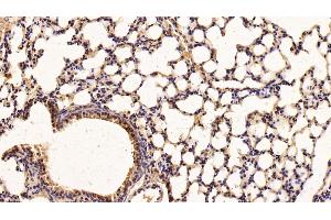 Detection of LIFR in Mouse Lung Tissue using Polyclonal Antibody to Leukemia Inhibitory Factor Receptor (LIFR)