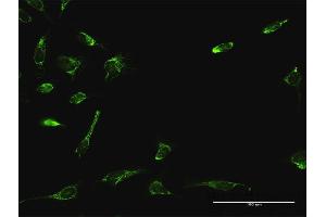 Immunofluorescence of purified MaxPab antibody to ATAD3A on HeLa cell. (ATAD3A anticorps  (AA 1-586))