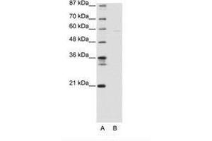 Image no. 1 for anti-SWI/SNF Related, Matrix Associated, Actin Dependent Regulator of Chromatin, Subfamily D, Member 3 (SMARCD3) (AA 139-188) antibody (ABIN6736140) (SMARCD3 anticorps  (AA 139-188))