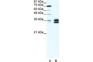 WB Suggested Anti-RELA Antibody Titration:  1. (NF-kB p65 anticorps  (N-Term))