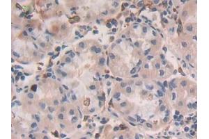 Detection of GHRH in Human Stomach Tissue using Polyclonal Antibody to Growth Hormone Releasing Hormone (GHRH)