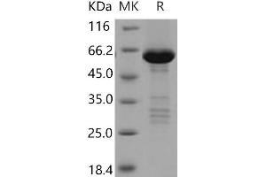 Western Blotting (WB) image for Tribbles Pseudokinase 2 (TRIB2) protein (GST tag,His tag) (ABIN7198335)
