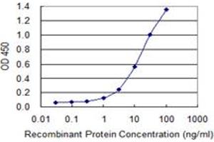 Detection limit for recombinant GST tagged ROCK2 is 0. (ROCK2 anticorps  (AA 1279-1388))