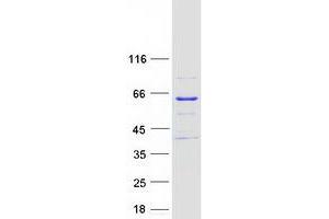 Validation with Western Blot