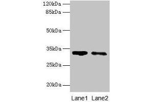 Western blot All lanes: SLA antibody at 5 μg/mL Lane 1: 293T whole cell lysate Lane 2: A431 whole cell lysate Secondary Goat polyclonal to rabbit IgG at 1/10000 dilution Predicted band size: 32, 20, 34, 28, 36 kDa Observed band size: 32 kDa (SLA anticorps  (AA 2-276))