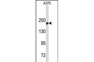 Western blot analysis of TOP2A Antibody (C-term) (ABIN653195 and ABIN2842744) in  cell line lysates (35 μg/lane). (Topoisomerase II alpha anticorps  (C-Term))