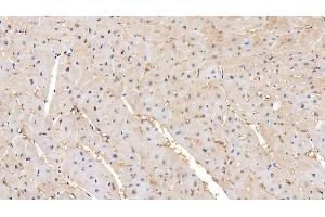 Detection of MMP2 in Human Cardiac Muscle Tissue using Polyclonal Antibody to Matrix Metalloproteinase 2 (MMP2)