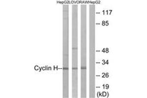 Western blot analysis of extracts from HepG2/LOVO/RAW264. (Cyclin H anticorps  (AA 274-323))