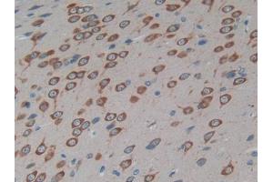 DAB staining on IHC-P; Samples: Rat Brain Tissue (Cx40/GJA5 anticorps  (AA 50-303))