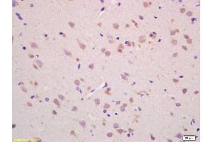 Formalin-fixed and paraffin embedded rat brain labeled with Rabbit Anti CHAC1 Polyclonal Antibody, Unconjugated (ABIN872557) at 1:200 followed by conjugation to the secondary antibody and DAB staining (CHAC1 anticorps  (AA 131-222))