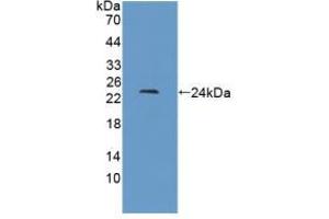 Western blot analysis of recombinant Cow IFNb. (IFNB1 anticorps  (AA 22-186))