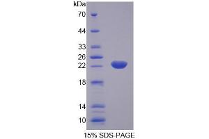SDS-PAGE analysis of Rat KTN1 Protein. (KTN1 Protéine)